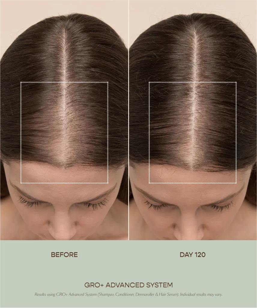 GRO  Advanced Balancing Shampoo and Conditioner Kit